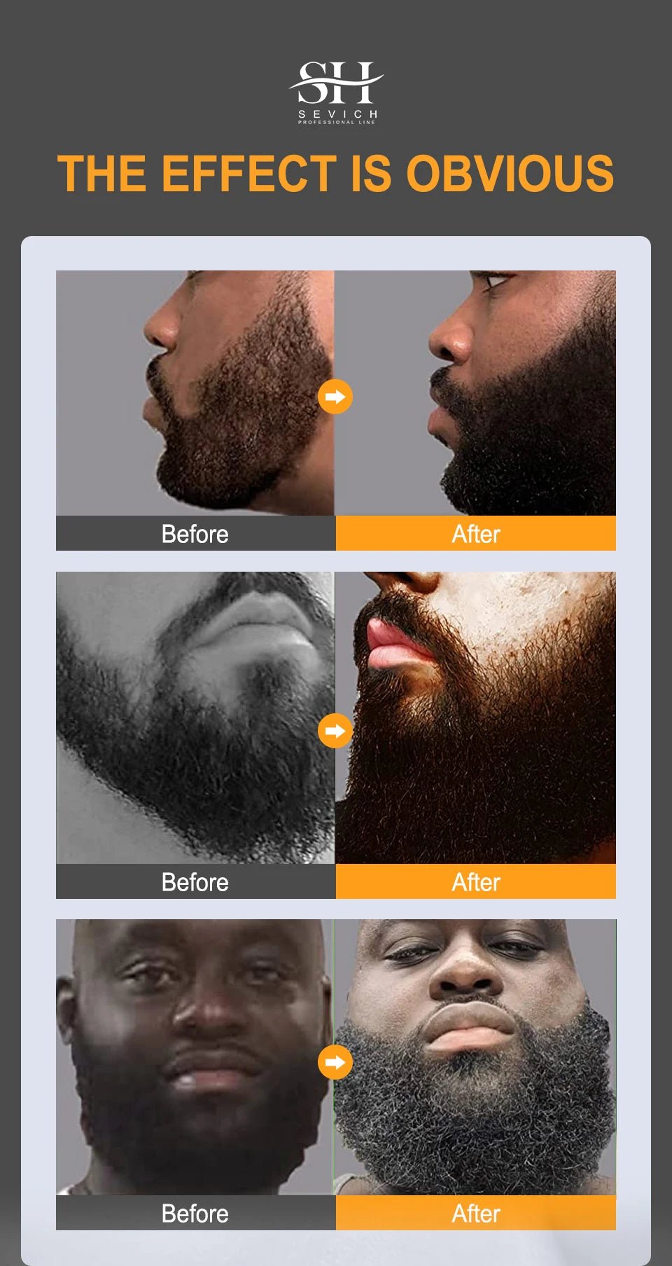 Men's Chebe Beard Serum - ALIZAMen's Chebe Beard SerumMen's Chebe Beard SerumMen's Chebe Beard SerumALIZAALIZAOriginalMen's Chebe Beard Serum